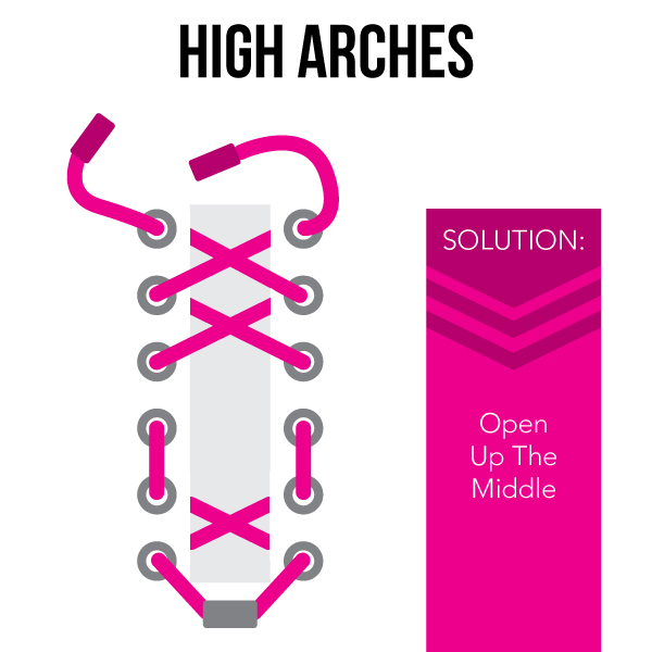 high arches