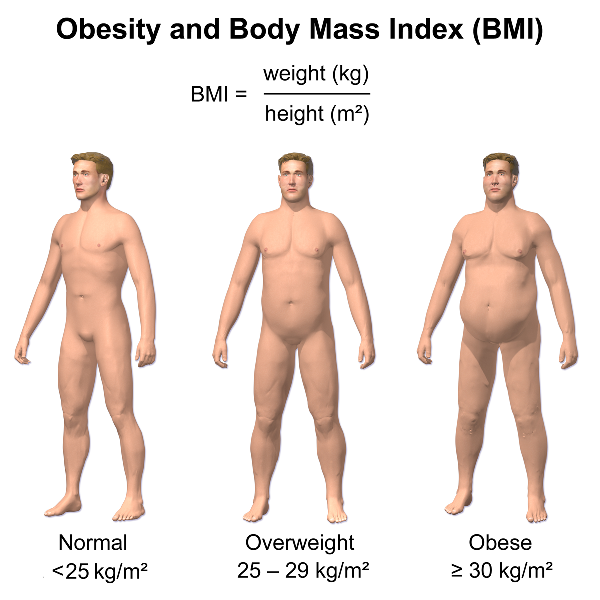 Obesity_&_BMI